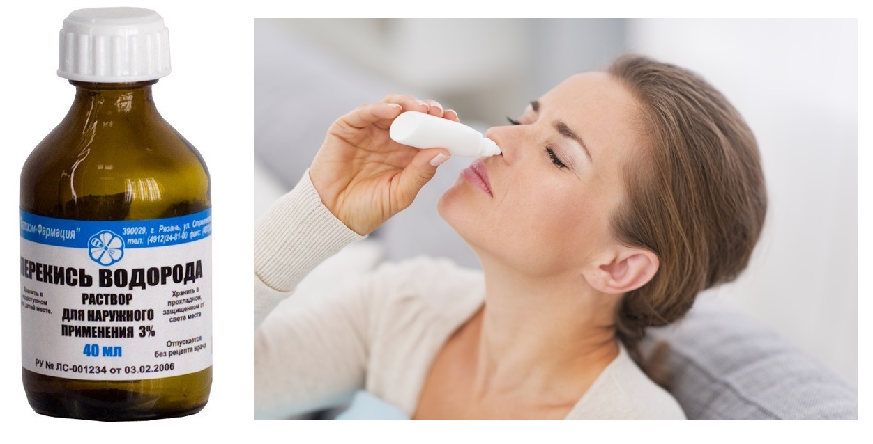 Девушка закапывает нос раствором перекиси