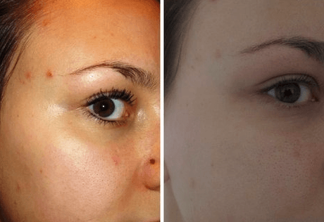 До и после применения болтушки