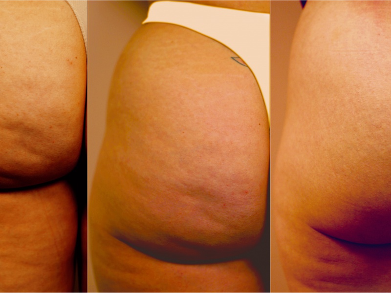 Фото до и после