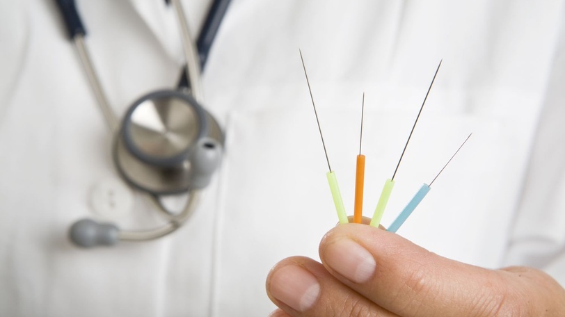 Иглотерапия