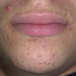 Подбородок