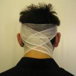 Лобно-затылочная повязка