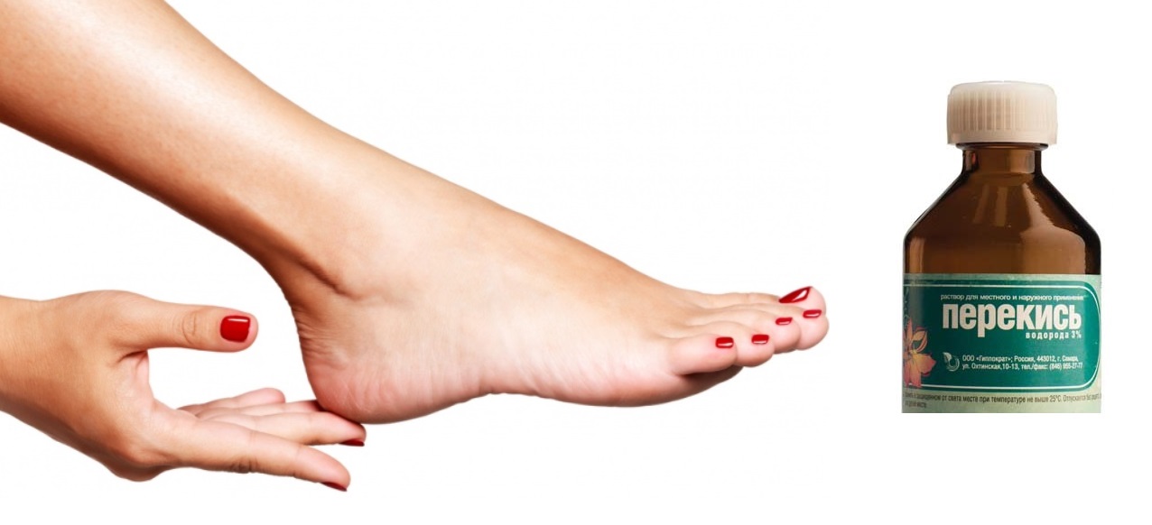 Рука, нога и перкись