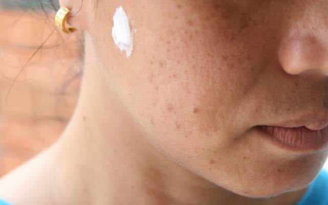 Точечное нанесение зубной пасты