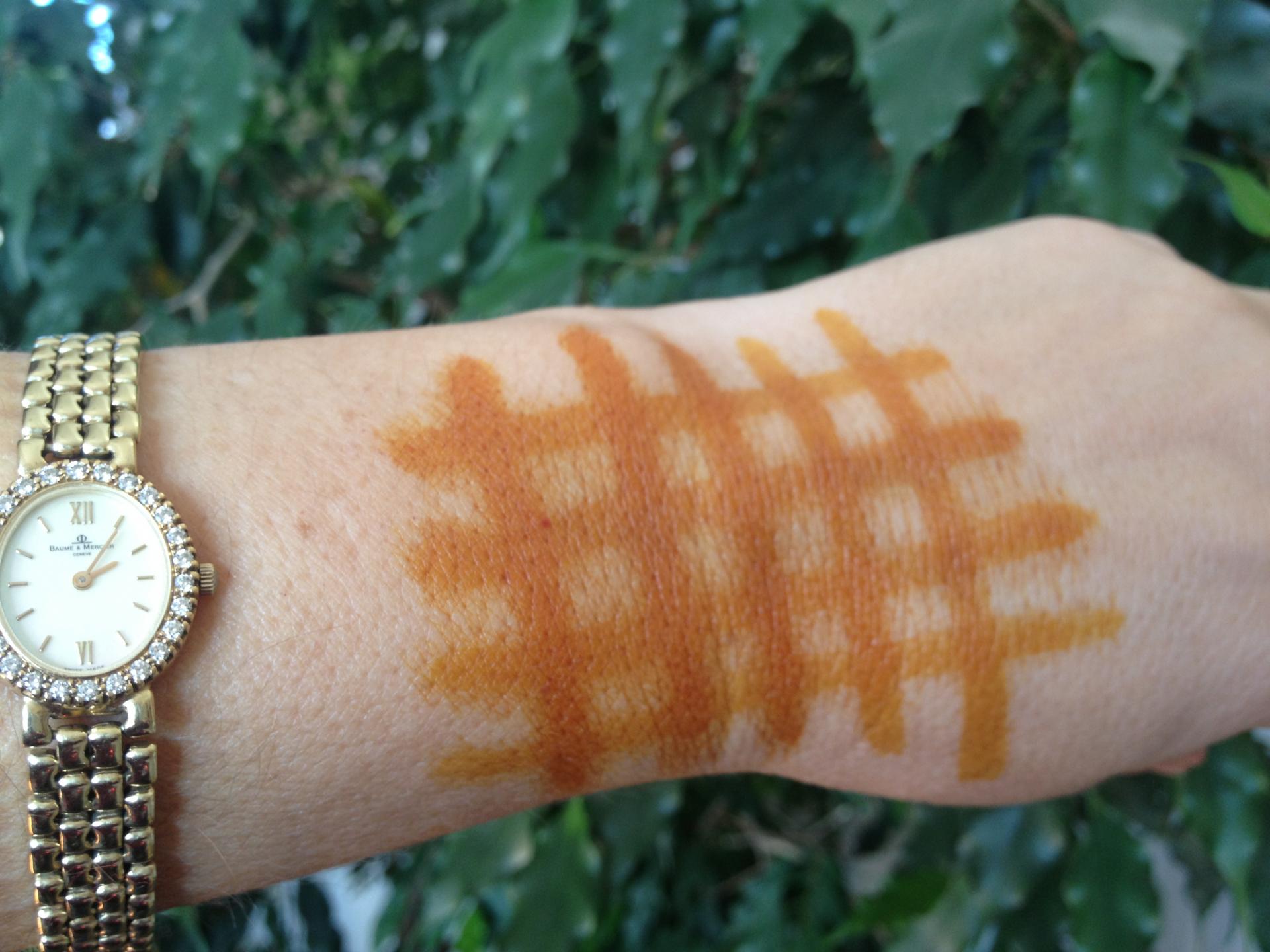 Йодовая сетка на запястье