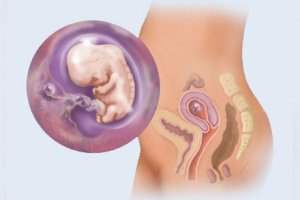 1 месяц беременности