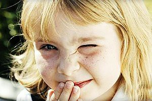 Частое моргание у детей: причины и методы лечения