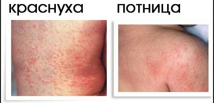 Фото: как выглядит потница